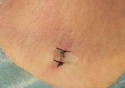 庆祝中国人民解放军98周年 中国当代名医——汪学军