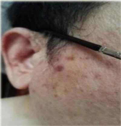 特别报道量子氢氧健康第一人长寿哥(廖永贵)　