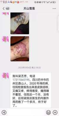 致敬最美劳动者——中医梁民刲