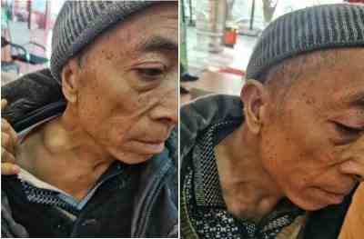 目前乳腺癌来一个治好一个 ——广西百色杨忠雅