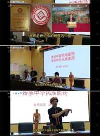 金秀瑶族灯草灸疗法 瑶医药非物质文化遗产传承人---赵衷民