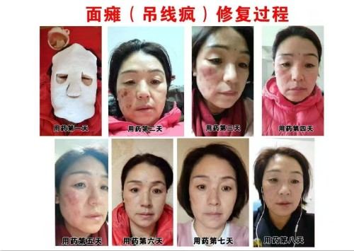 医道同源 慧慈济世 悟慧慈智法师的中医药文化传承之路