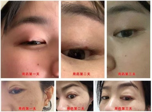 医道同源 慧慈济世 悟慧慈智法师的中医药文化传承之路